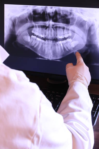 Best Broken or Chipped Tooth Repair in Jefferson, OH